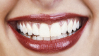 smileDM2409_468x349.jpg