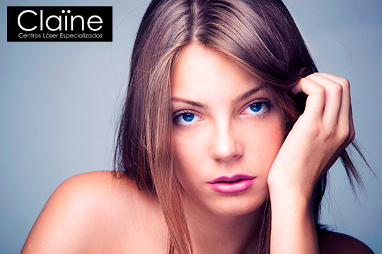 Claine