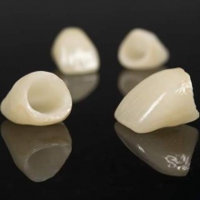 Estetic Nou Implant