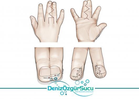 Deniz Özgür Sucu-2