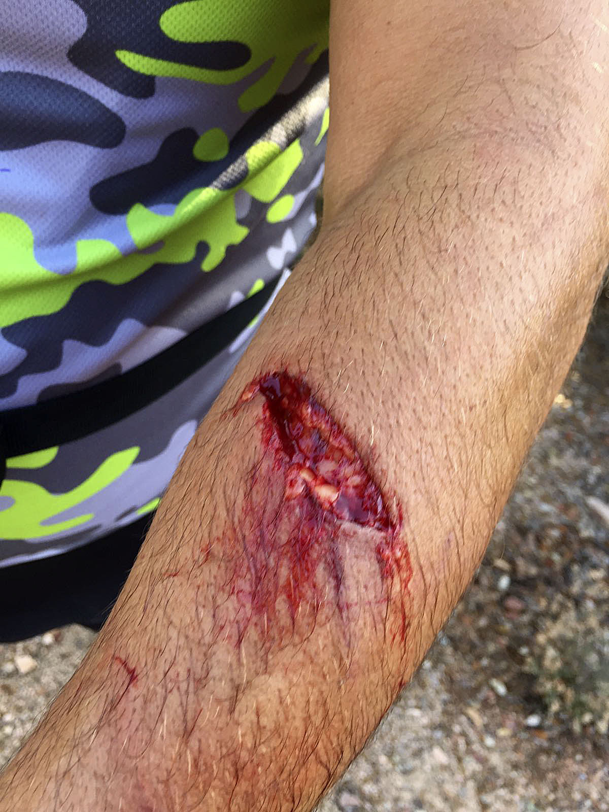 L'home ha hagut de ser traslladat amb ambulància a Vic