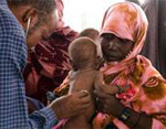 MSF doctor examines baby
