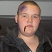 mikkel