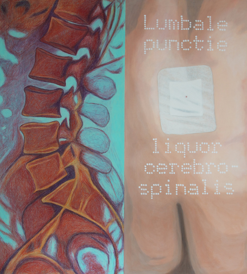 Look (at) inside me; Lumbale punctie, Liquor Cerebrospinalis