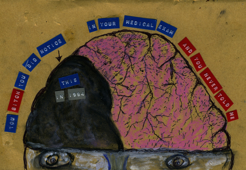 BRAIN 1994