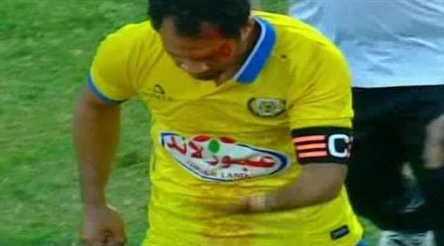موقف حكيم من القيصر بعد إصابته بنزيف في لقاء سموحة