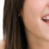 10 razones para ponerte ortodoncia | Blog de Masquemedicos