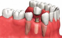 Dentalux