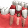 Dentalux