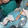 Sinuplastia - Manuel Sáinz Quevedo