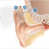 Otros implantes - Manuel Sáinz Quevedo