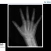 Estudio RX Mano-Pulso - RADMEDICA