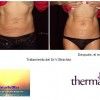 Thermage CPT en el Centro NaturSolMar Valencia-radiofrecuencia corporal-Abdomen. - Centro NaturSolMar