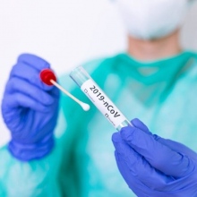 Centro Diagnostico Cavour Screening Covid-19, Covid Test Bologna