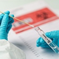 IGEA SALUS Centro Medico Screening Covid-19