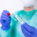 Diagnostica Mori Screening Covid-19
