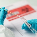 Redimedica Screening Covid-19