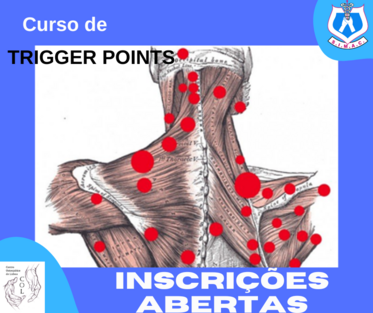 Trigger poinst 1