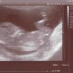 profile image of Anna Nicholls