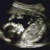 profile image of Juvi S Khemiri