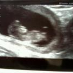 profile image of Becca Rennie