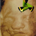 William T Waldram