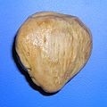 Chondromalacja Rzepki