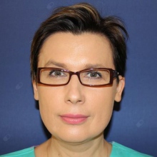 Anna Olender, chirurg plastyczny Żarki-Letnisko