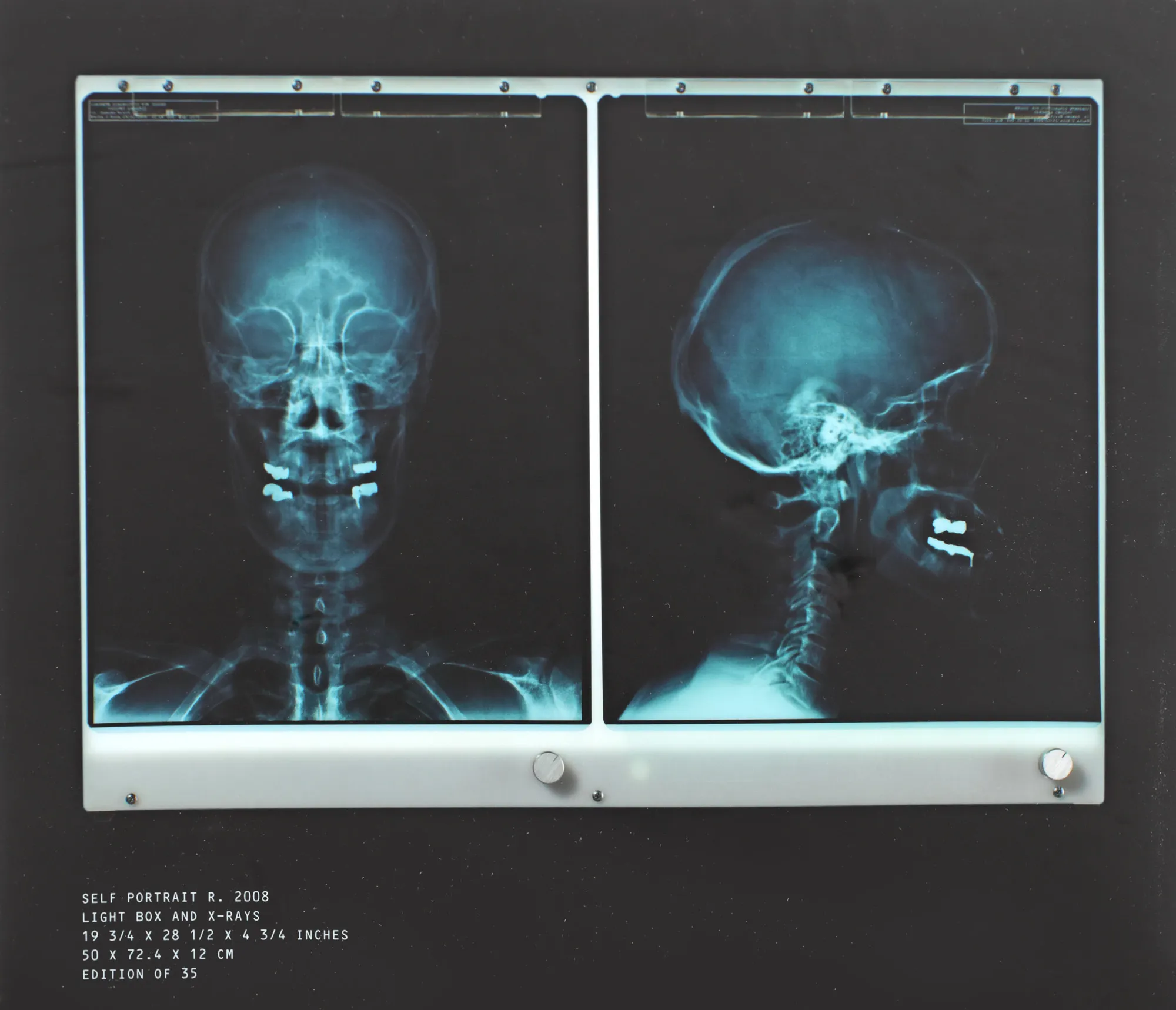 Self Portrait X-Ray