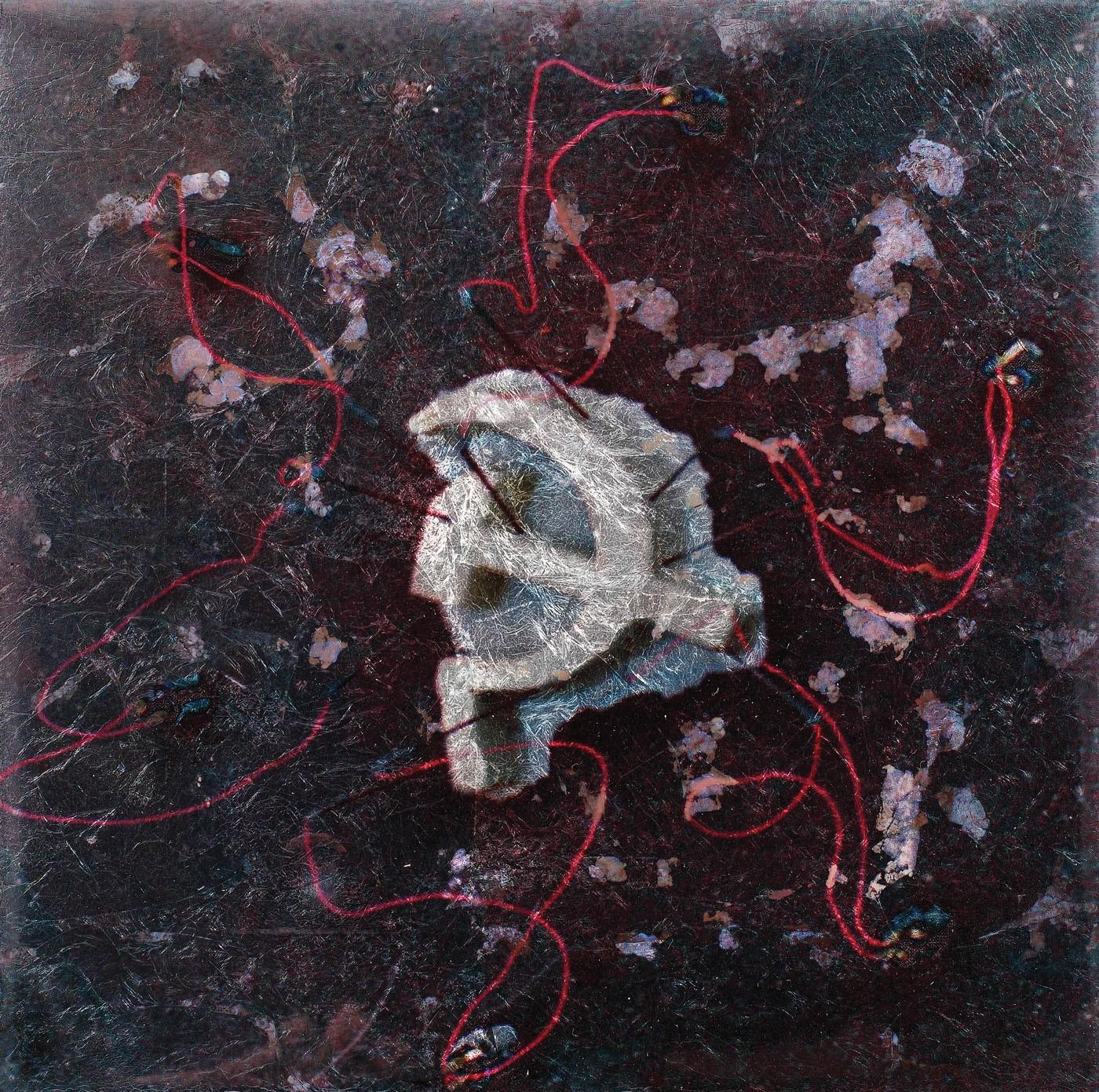 Amnezie