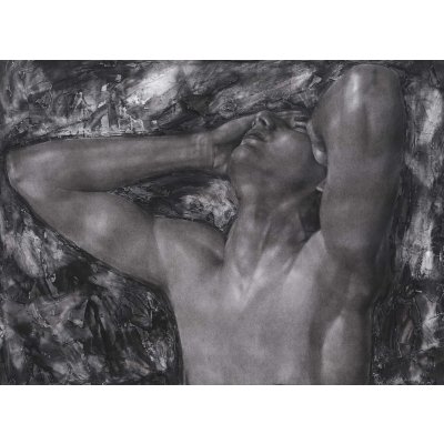  Pe cord deschis (Open Heart Surgery)