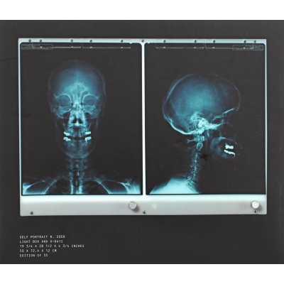 Self Portrait X-Ray
