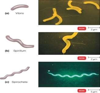 04-04_SpiralBacteria_1.jpg
