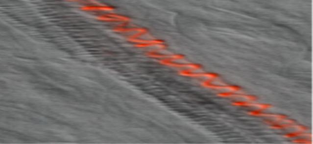 <i>Improper lignification (red) of xylem vessels as symptom of copper insufficiency (LM)</i>