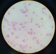 C:\Users\Kuntha\Pictures\lab\IMG_1876.JPG