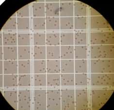 http://biology.clc.uc.edu/fankhauser/Labs/Anatomy_&_Physiology/A&P202/Blood/blood_cell_count_jpgs/25_RBC_LR_PP3120163.JPG