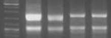 D:\MRYM\RNA 10mth 2013-04-04 15hr 26min.jpg