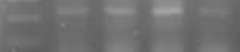 D:\MRYM\op1 2mth trt 27.4.jpg