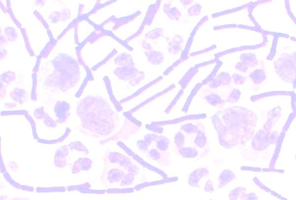 Botulism mode of transmission picture