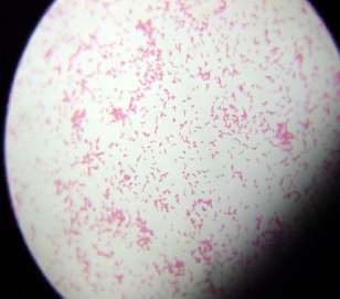 http://loudoun.nvcc.edu/vetonline/vet132/micro/images/gram_negative.jpg