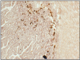 IHC-A-Gut.jpg
