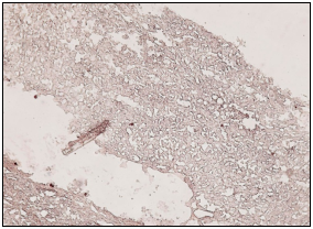 IHC-3.jpg