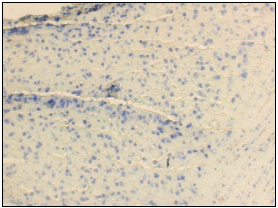 IHC-C-Brain.jpg