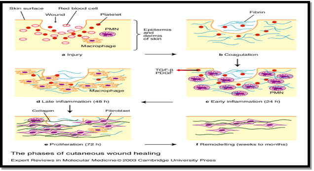 Diagrams of the Phases of Cutanaeous Wound Healing