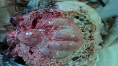 Dorsal view of the African ostrich brain