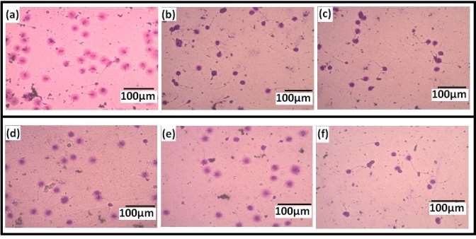 C:UsersRANJITADesktopNew folderFig 5 Image Analysis of Damage a) Control Slide b) Tetracycline at 8% concentration after 3hrs of incubation c) Bisphenol A at 8% concentration after 3hrs of incubation d) Monosodium Glutamate at 8% concentration after.jpg