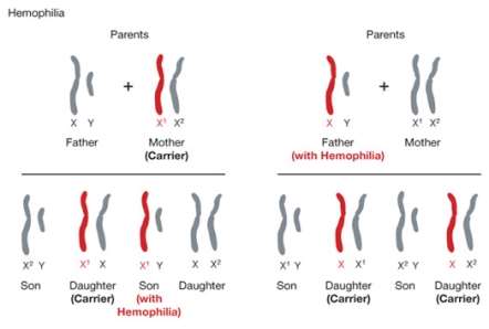 http://geneed.nlm.nih.gov/images/hemophilia_sm.jpg