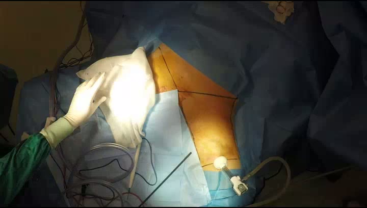 Plataforma de vídeo de la Asociación Española de Urología