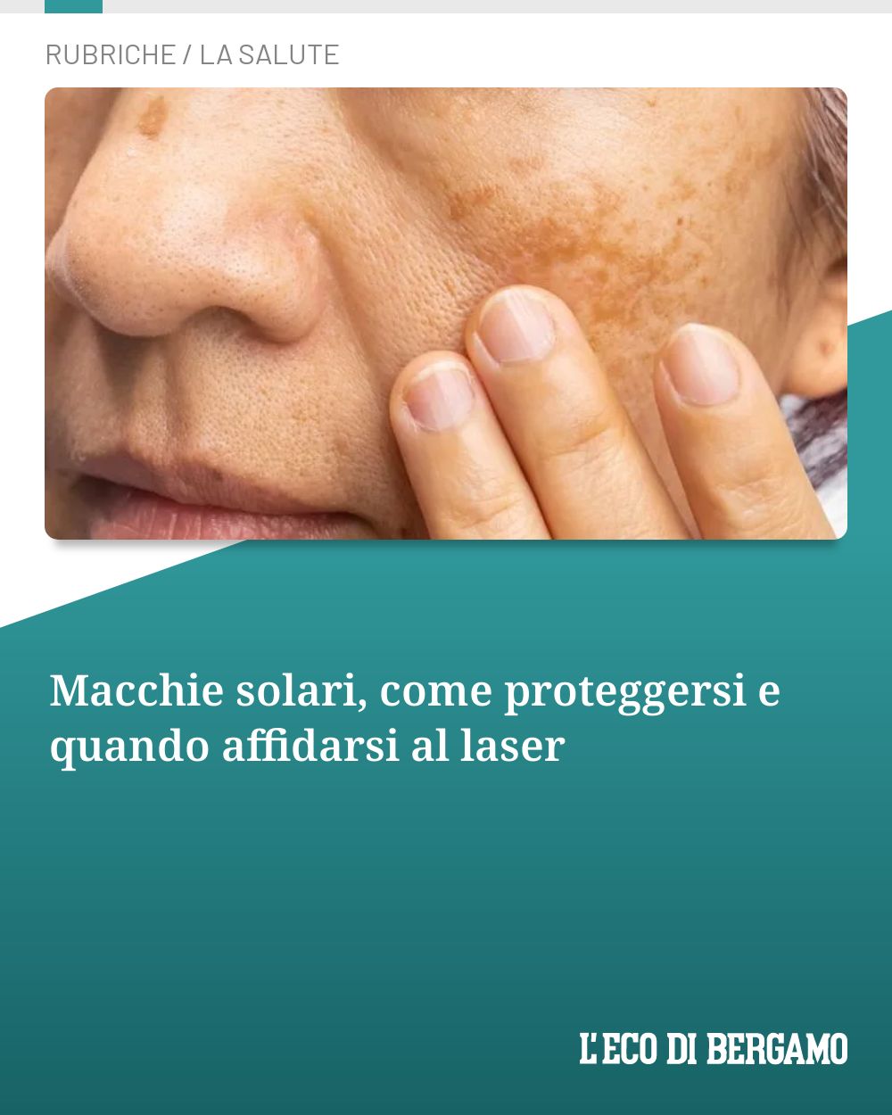 Post Instagram @ecodibergamo: Macchie solari, come proteggersi e quando affidarsi al laser...