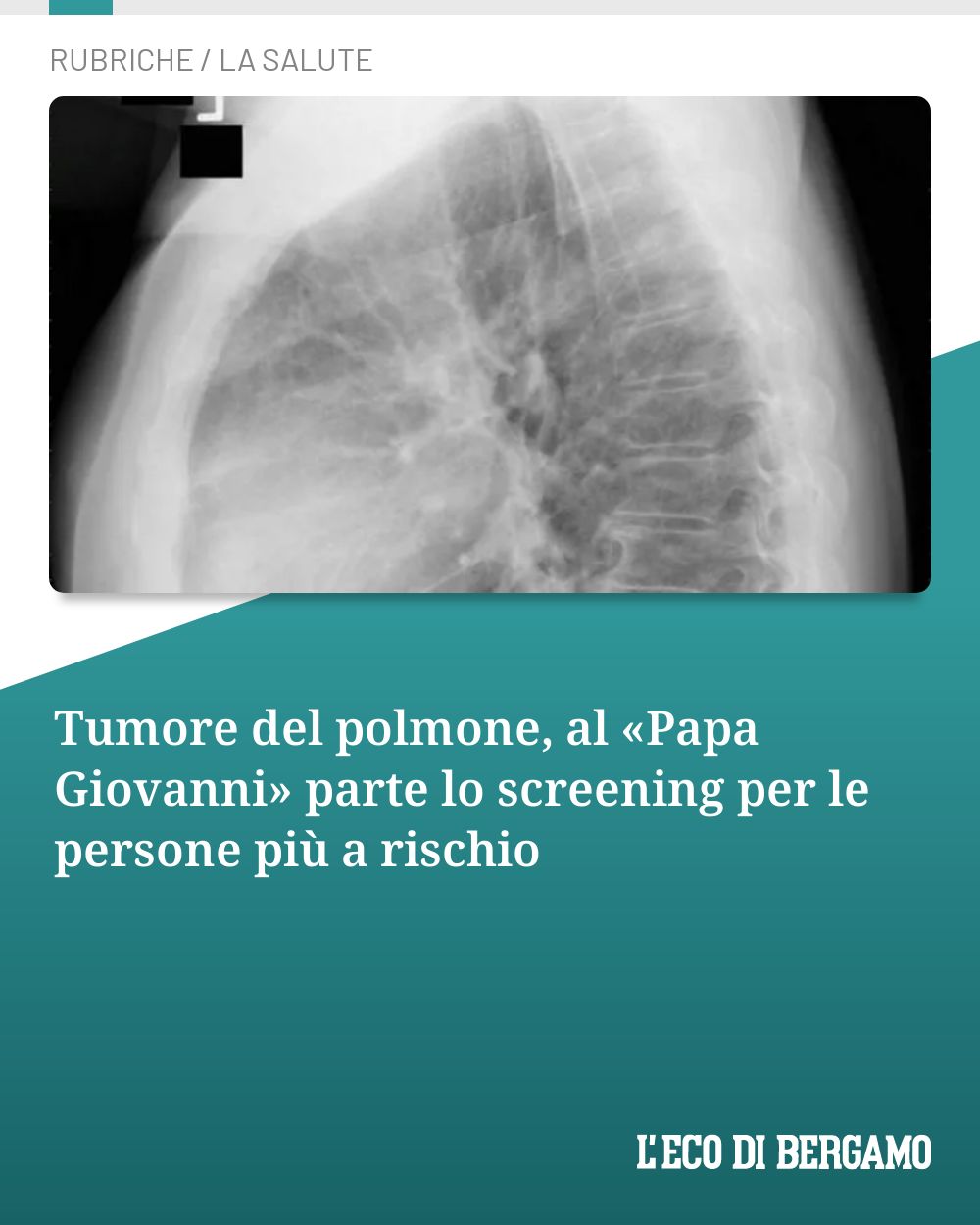 Post Instagram @ecodibergamo: Tumore del polmone, al «Papa Giovanni» parte lo screening per le persone più a rischio...